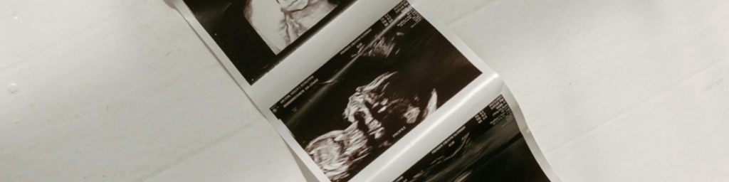 toledo ultrasound help